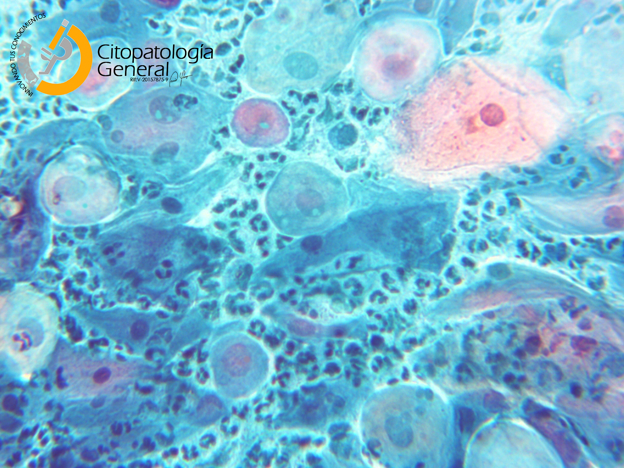 Хламидии 4. Хламидия трахоматис под микроскопом.